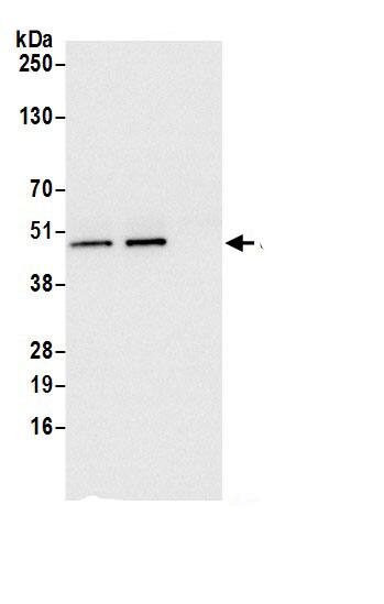 UQCRC2 Antibody