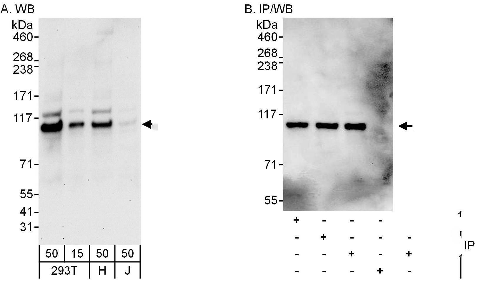 beta Adducin Antibody