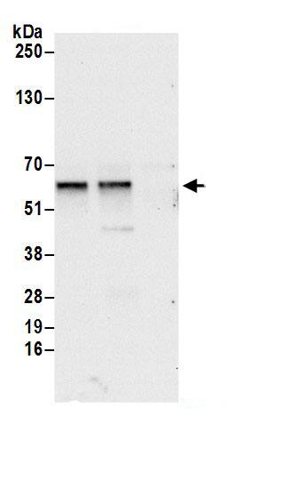 dynactin 4 Antibody