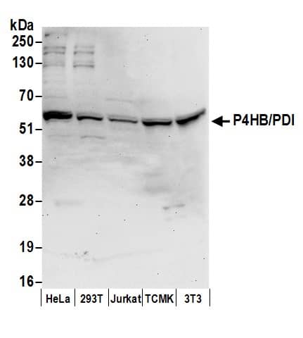 Protein Disulfide Isomerase/P4HB Antibody