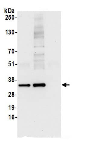 ARPC2 Antibody