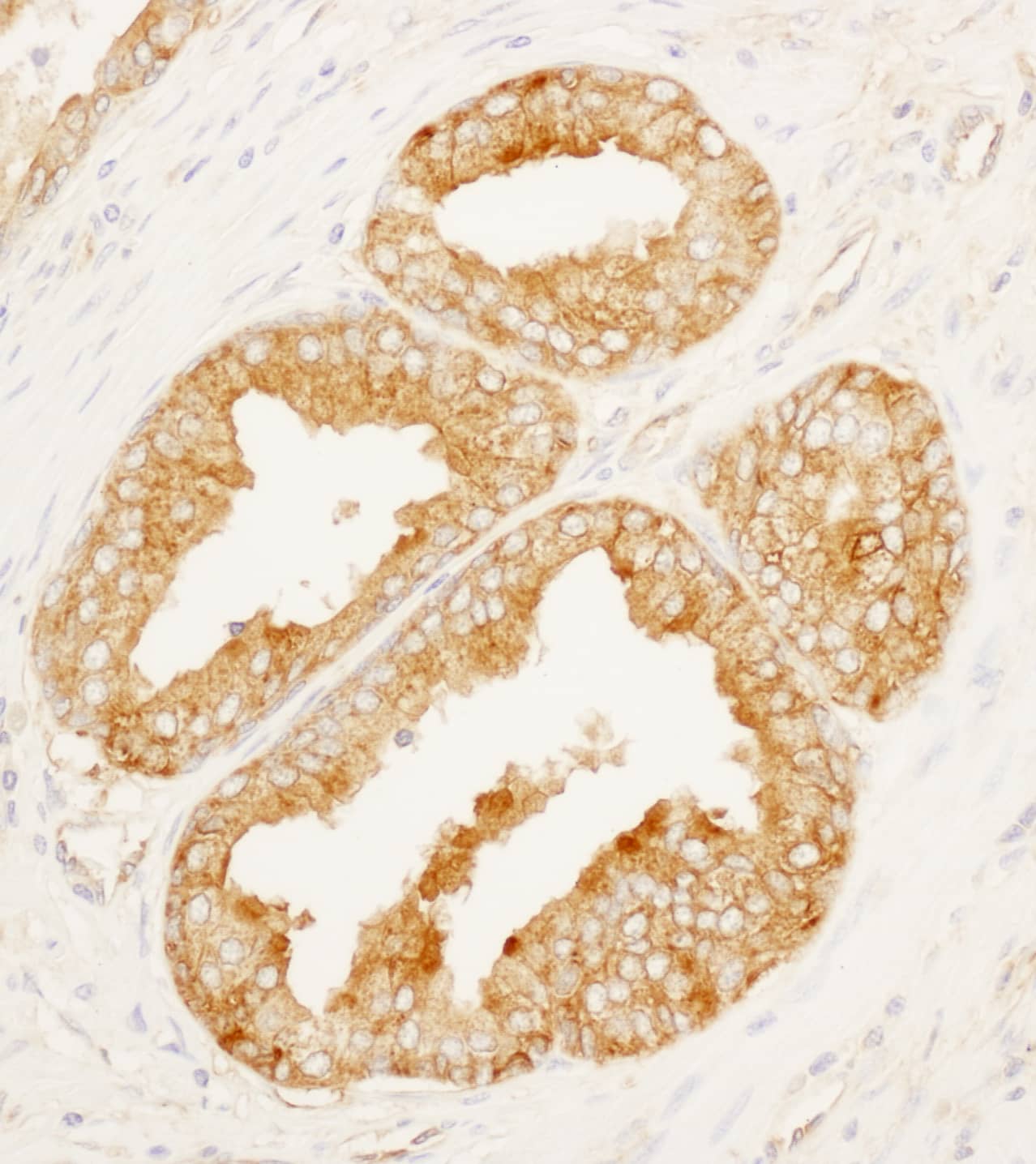 MARCKS like protein Antibody