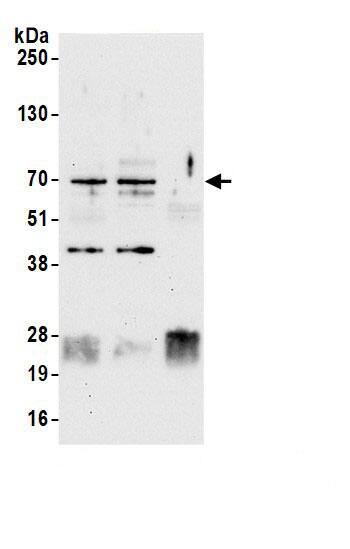 CBX4 Antibody