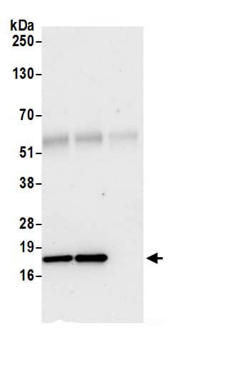 NDUFB6 Antibody