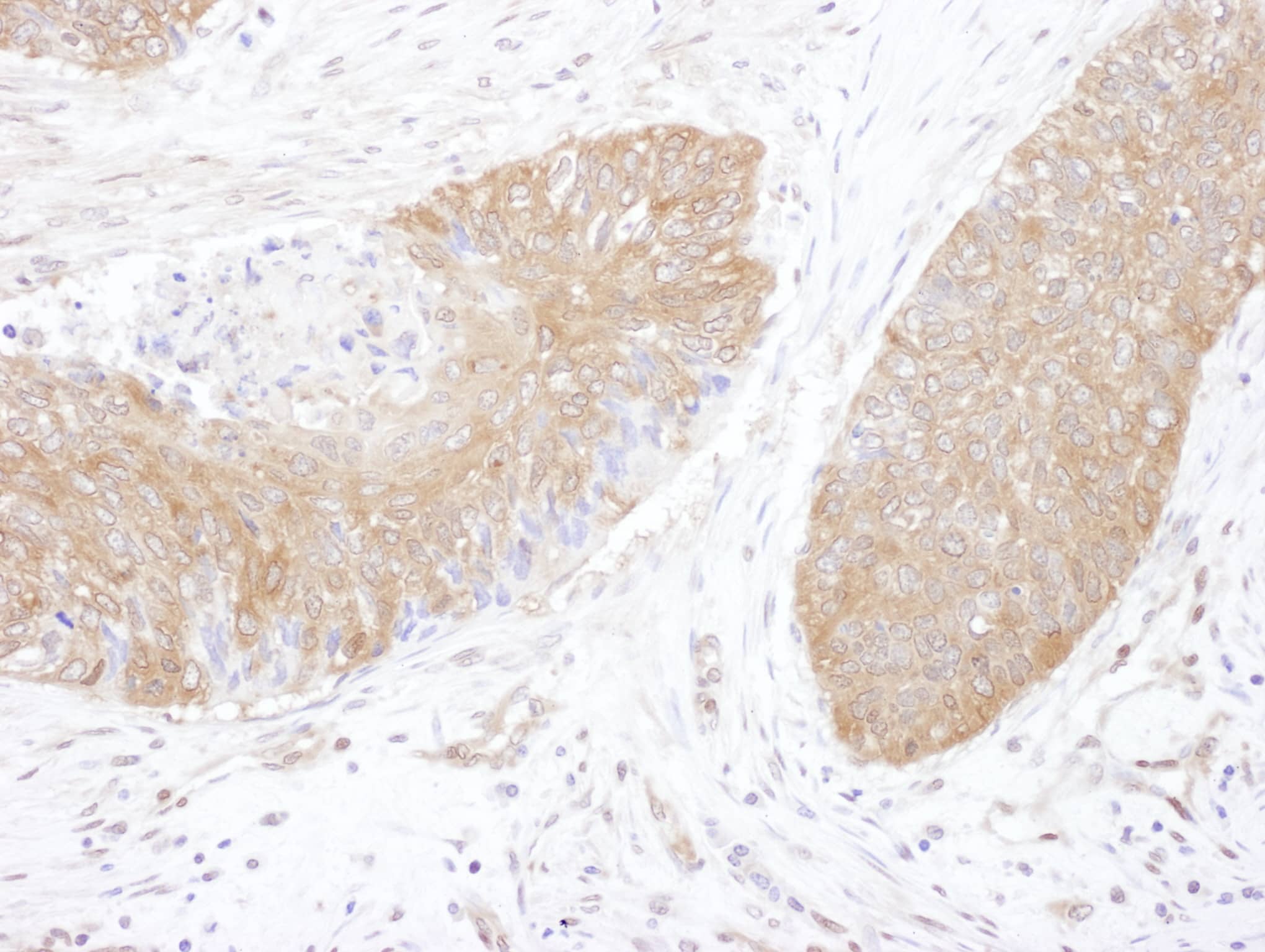 CCT5 Antibody