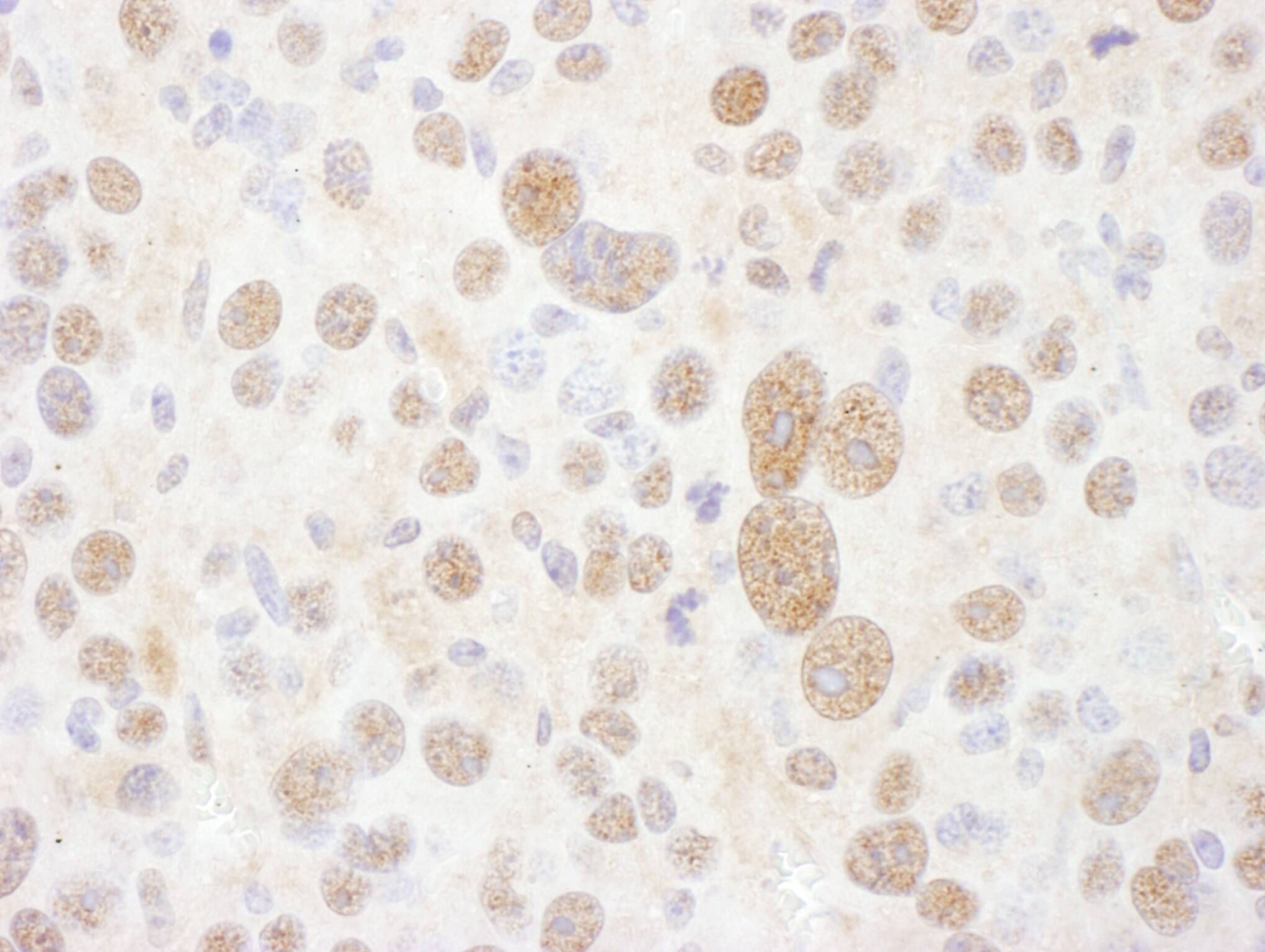 Proteasome 19S S7 Antibody