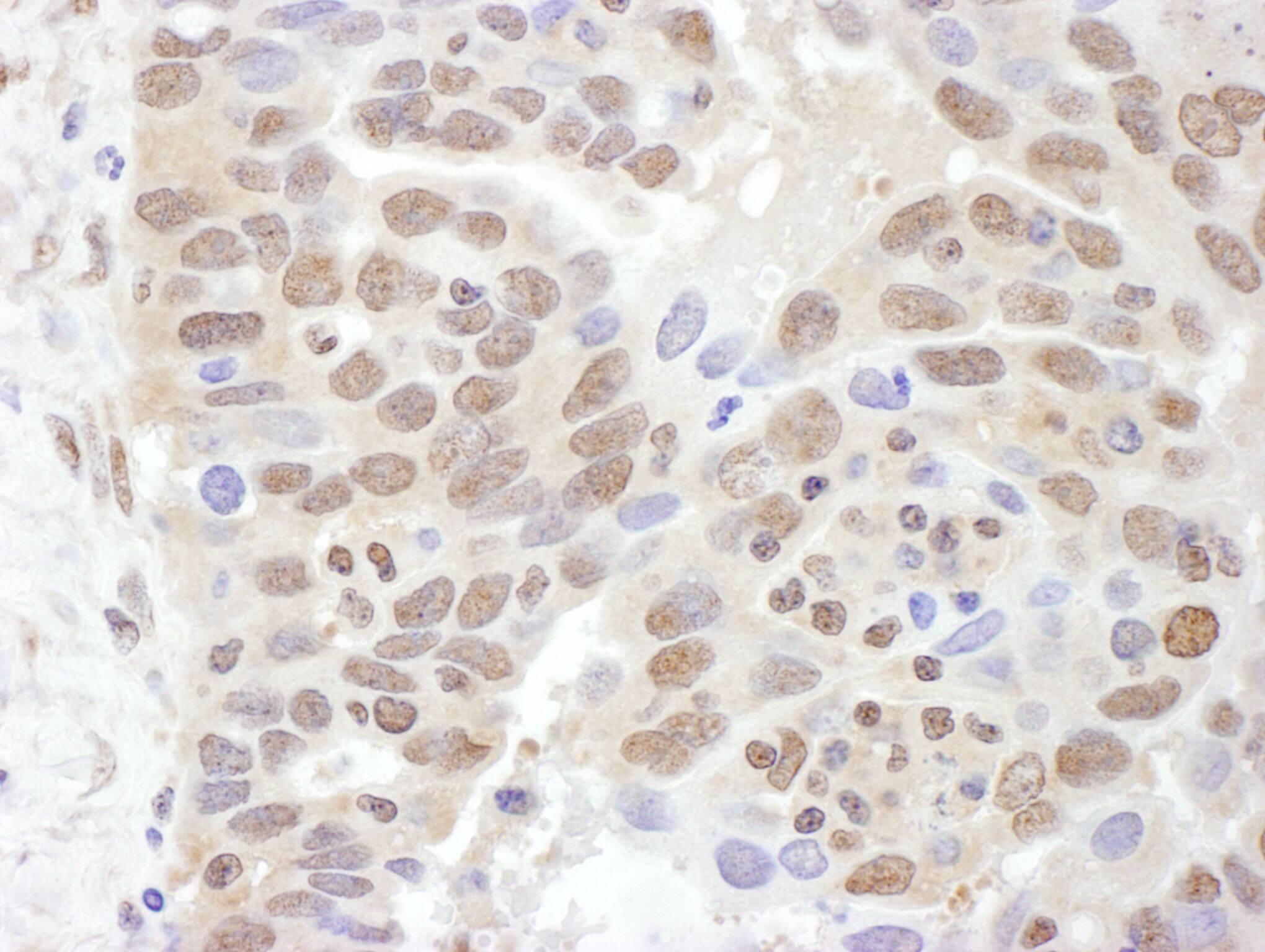 Proteasome 19S S7 Antibody