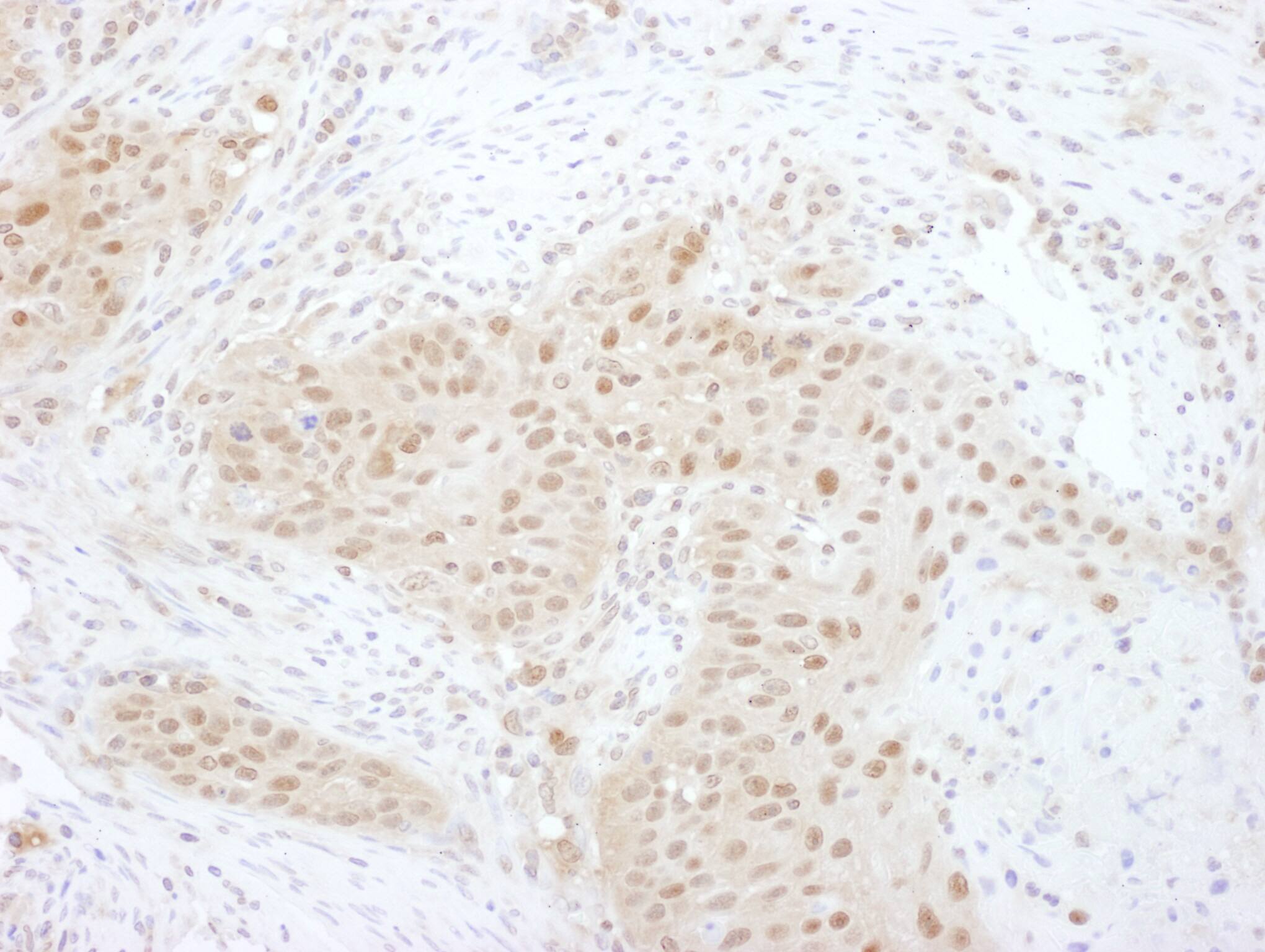 PSMD7 Antibody