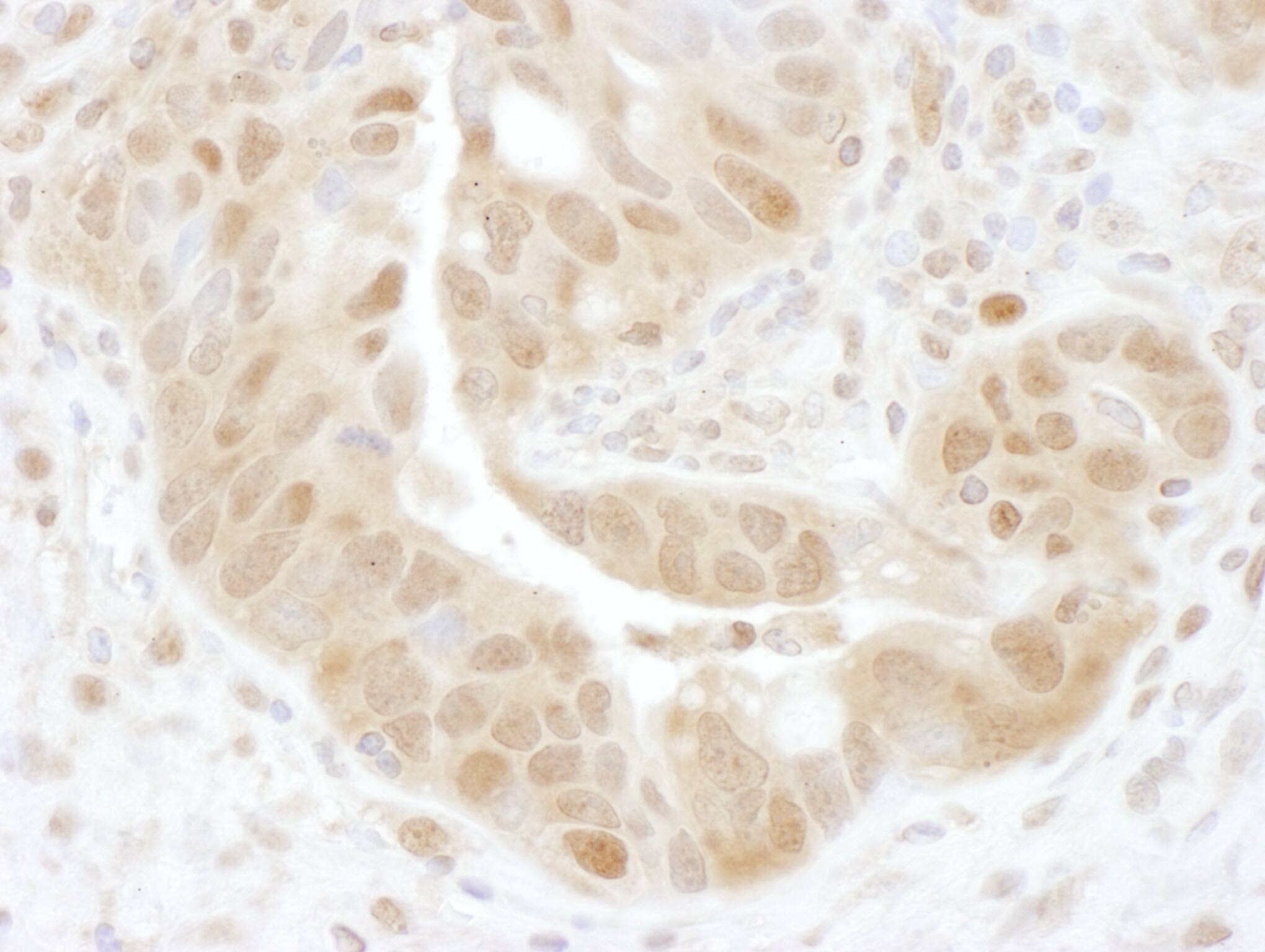 PSMD7 Antibody
