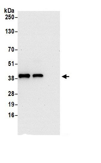 PDCL Antibody