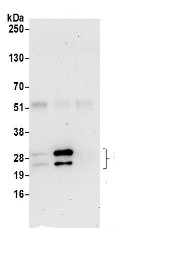 CHCHD3 Antibody