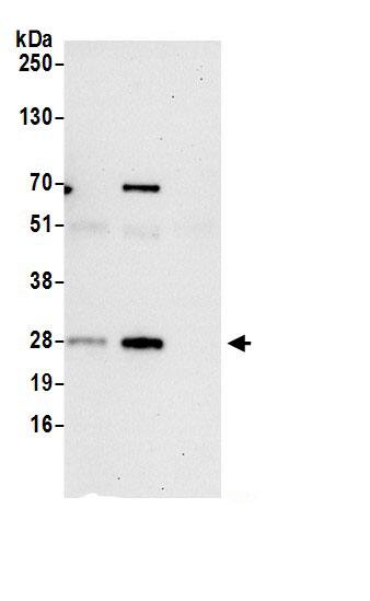 IDI1 Antibody