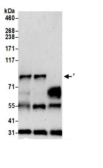 ELAC2 Antibody