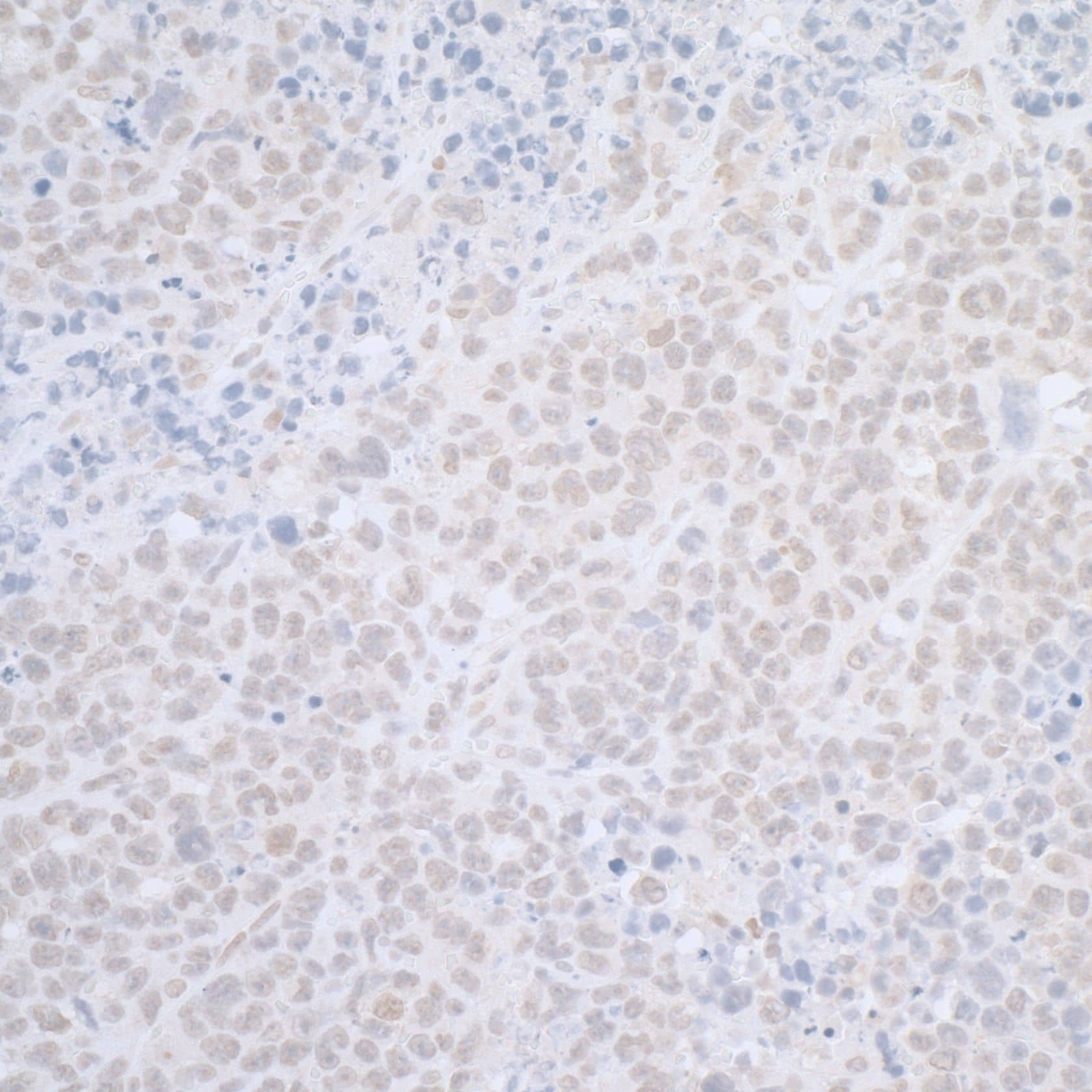 ELAC2 Antibody