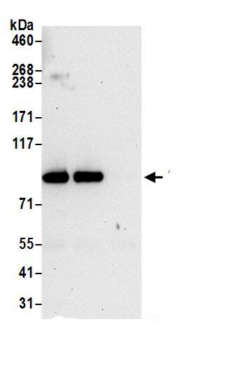 AMPD3 Antibody