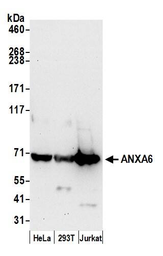 Annexin A6 Antibody