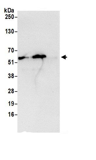 ATP5A Antibody