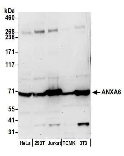 Annexin A6 Antibody