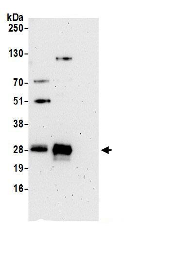 STARD3NL Antibody