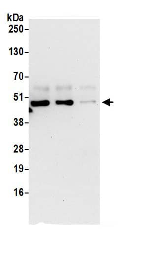 P2X5/P2RX5 Antibody