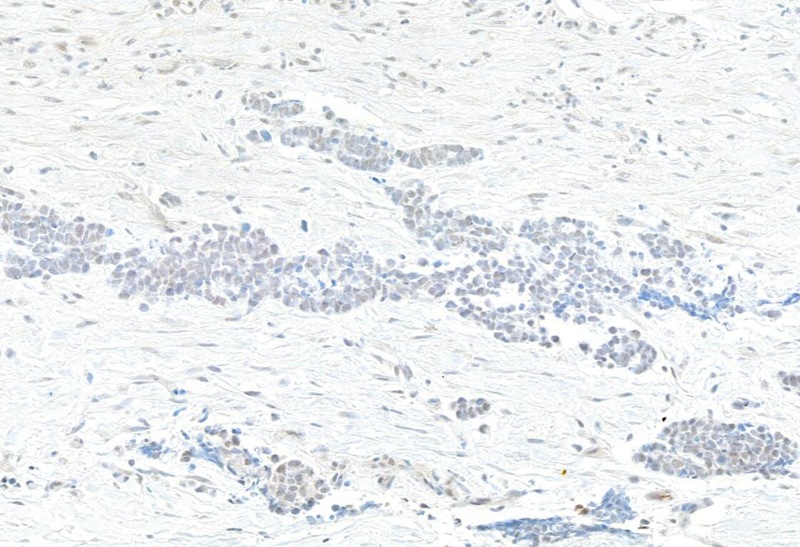 KAT4/TBP Associated Factor 1 Antibody