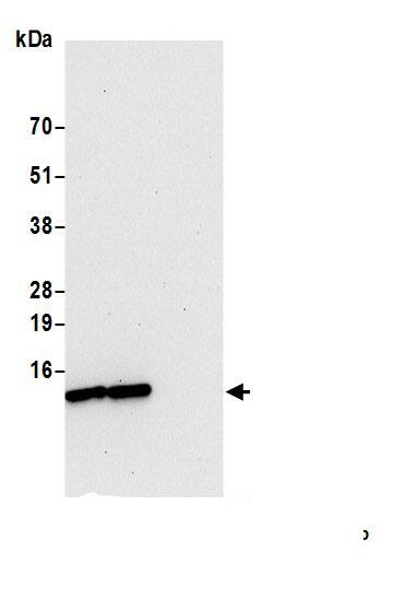 VMA21 Antibody