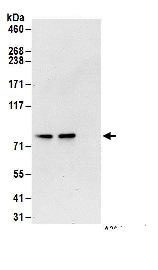 Transglutaminase 2/TGM2 Antibody