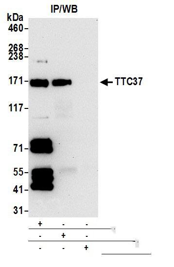 TTC37 Antibody