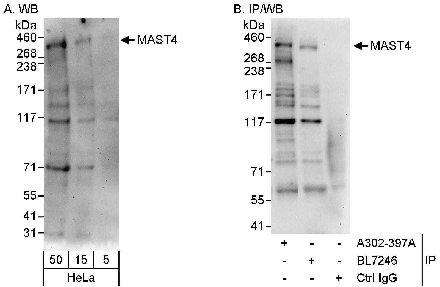 MAST4 Antibody