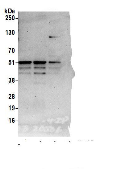 TADA3L Antibody