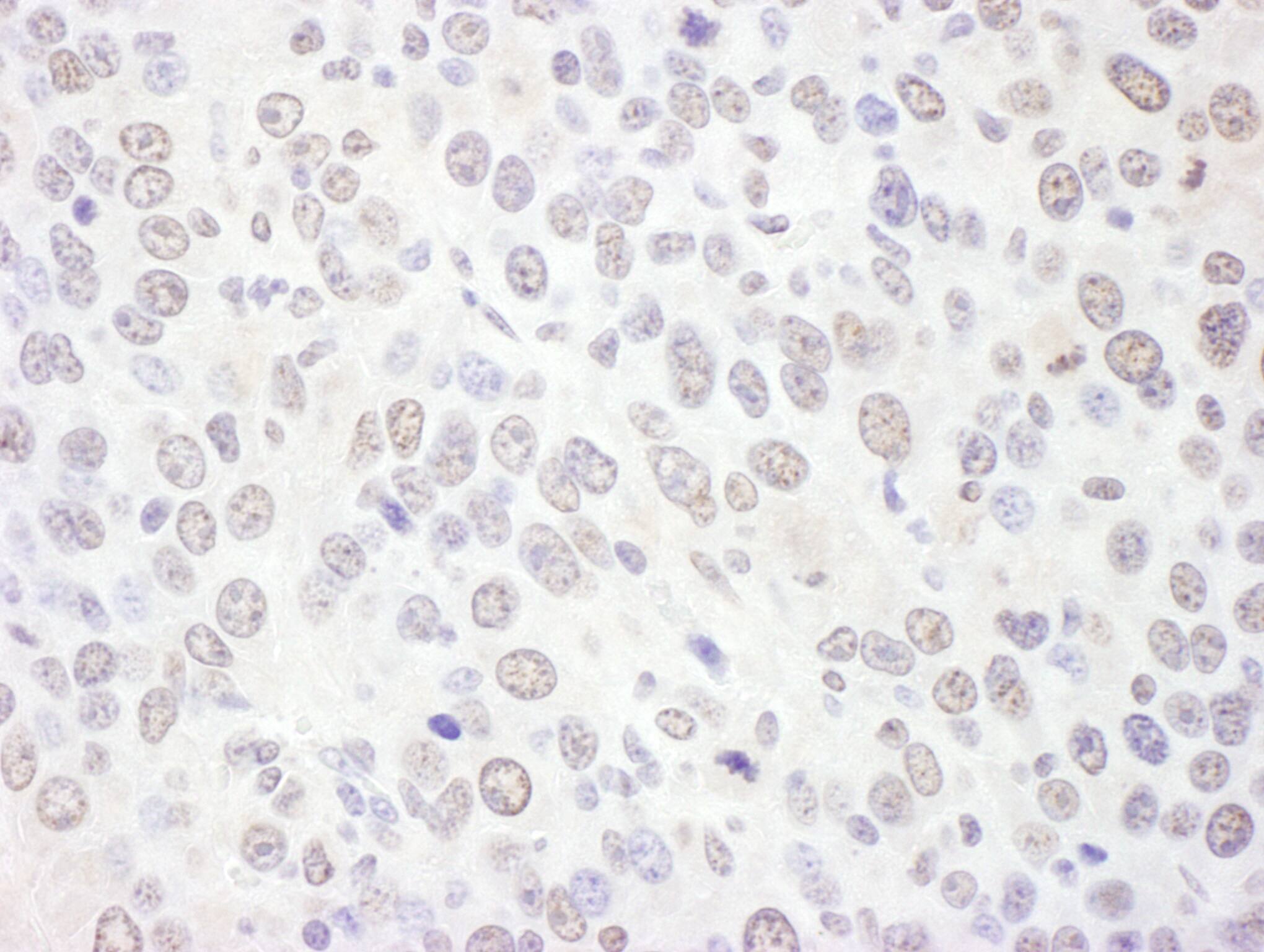 Exosome component 10 Antibody