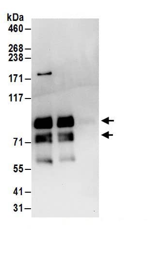 MEPCE Antibody