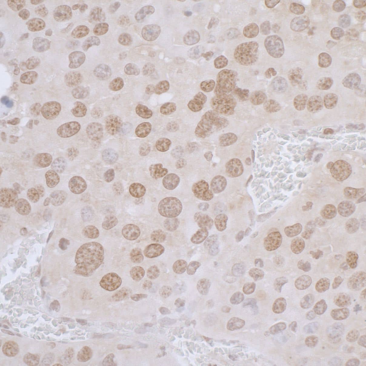 Thymopoietin/LAP2 Antibody