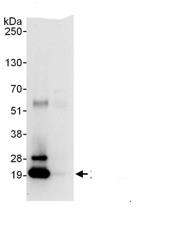 PSMB5 Antibody