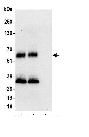 Lymphotoxin beta R/TNFRSF3 Antibody