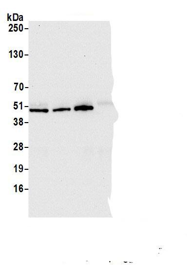 BCKDHA Antibody