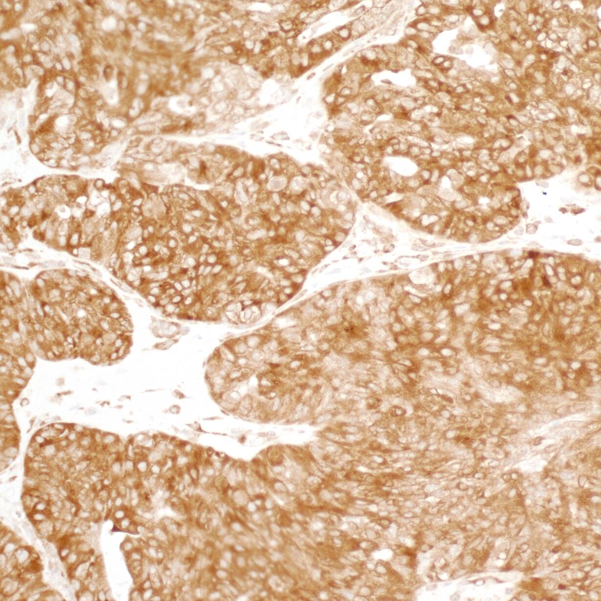 YB1 Antibody