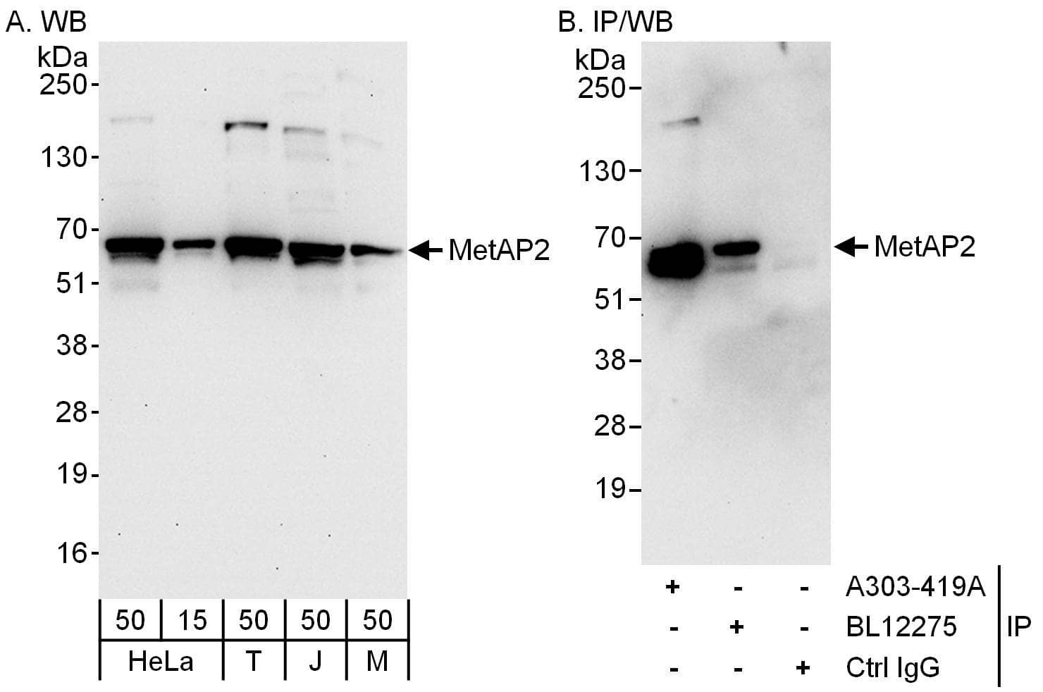 Methionine Aminopeptidase 2/METAP2 Antibody