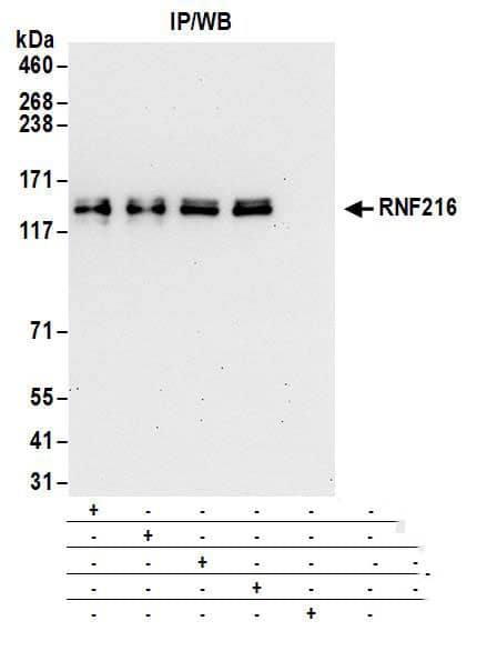 TRIAD3 Antibody