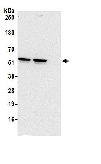 TSPYL1 Antibody