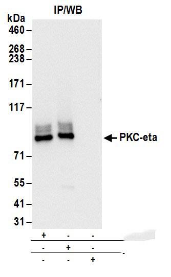PKC eta Antibody