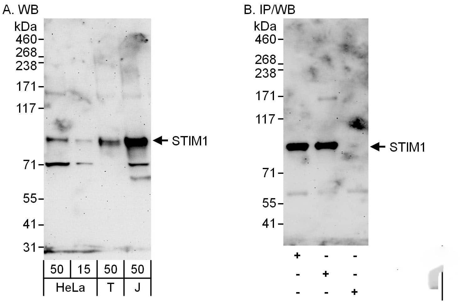 STIM1 Antibody