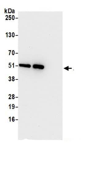 ETEA Antibody