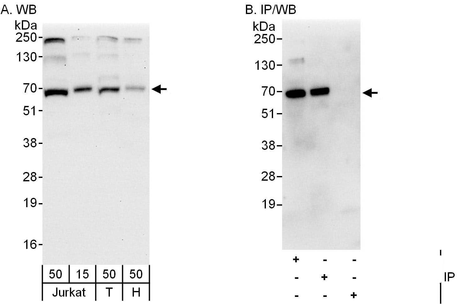 Atlastin-2 Antibody