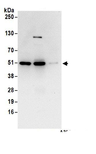 CSK Antibody