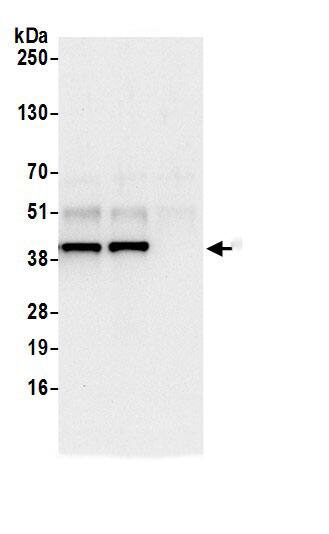 ACTR2 Antibody