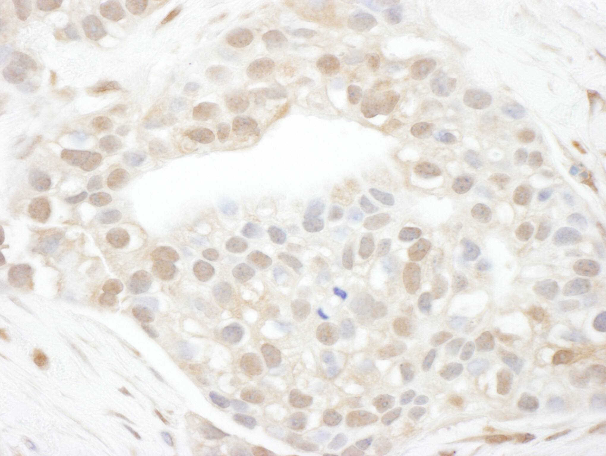 Cyclin T1 Antibody