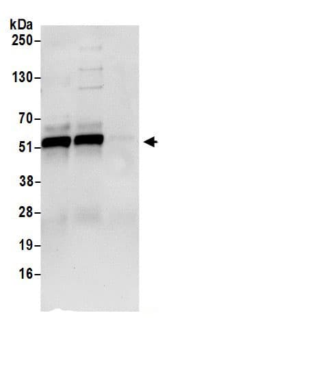 Adenylosuccinate Lyase Antibody