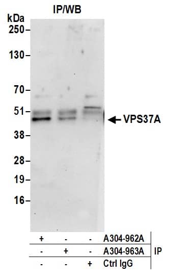 VPS37A Antibody