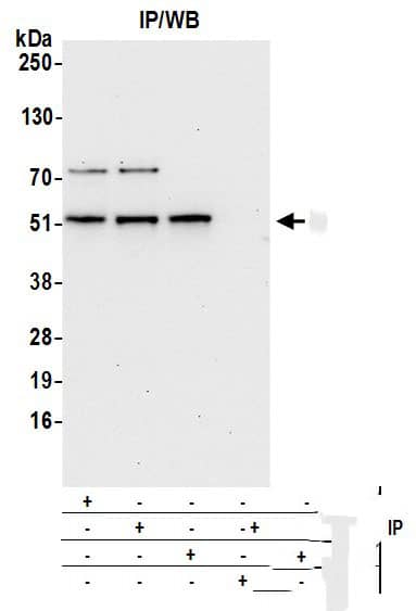 DDX47 Antibody